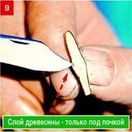 Щеплення &ndash; складно, але цілком можливо. Частина 2. Окулировка.